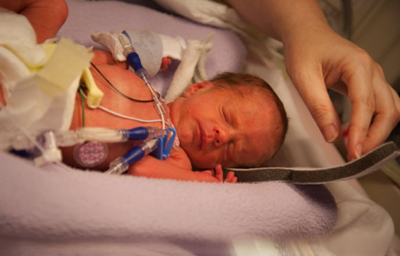 One in 10 babies are born prematurely in the UK