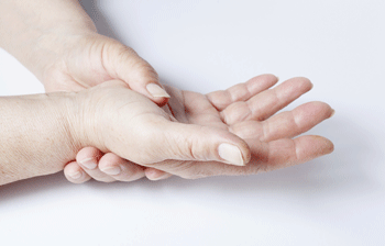 Arthritis