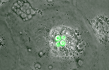 A bird macrophages infected with the fungal pathogen Cryptococcus neoformans (green)