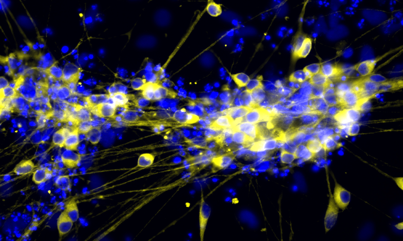 Enteric Neurons
