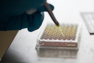 Image of postgraduate student working with medical equipment (pipette)