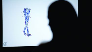 Insigneo model of human legs