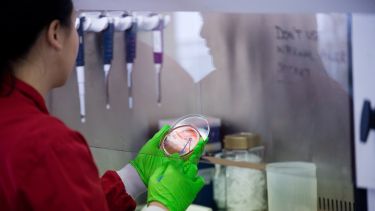 Image of postgraduate medical student with green gloves inspecting sample