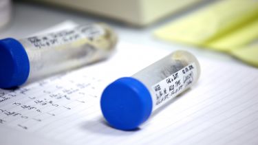 Biomedical Science: test tube samples