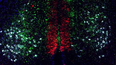 Brain-integrating systems
