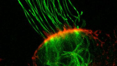 Cilia in the zebrafish ear