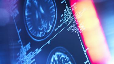 Brain scans