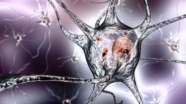 Parkinson's disease: nerve cells - illustration