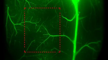 Mouse cerebral cortex with fluorescent dye highlighting vasculature