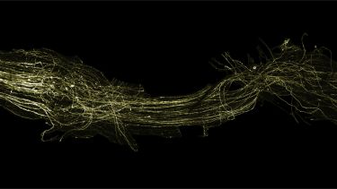 Neuroscience trigeminal nerve graft