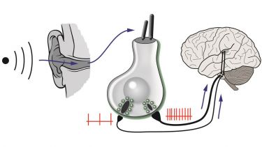 Ear and stereocilia