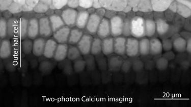 Outer hair cells of the ear