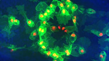 Macrophages at wound.