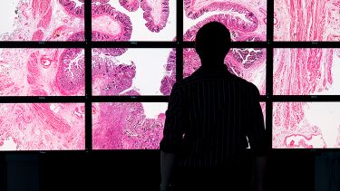 North receives £10 million government investment for AI and digital pathology