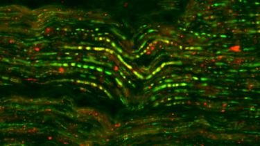 Trigeminal research