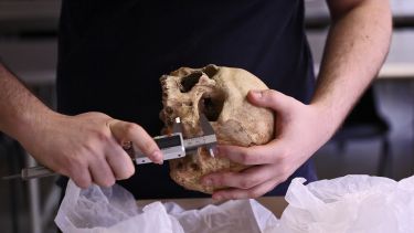 A person holds a human skull, using lab equipment to measure the size of its jaw bone.