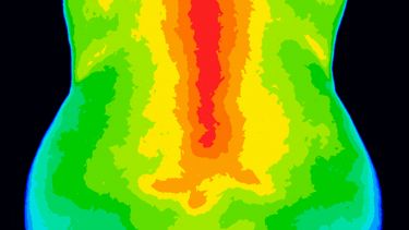 Thermal Imaging