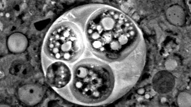 Spherical particle of fly ash containing smaller particles within its hollow structure