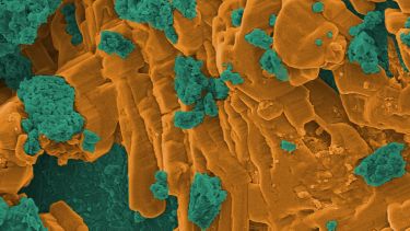 Microstructure of cement