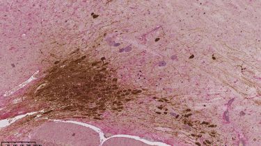 Immunohistochemistry
