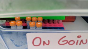 samples in a box