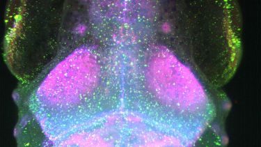 Scientific image showing Dorsal view of a 9-day old zebrafish brain