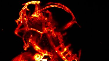Head vasculature in a two day old zebrafish (side view)
