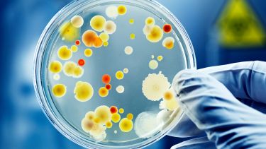 Researcher's hand holding a petri dish to the light