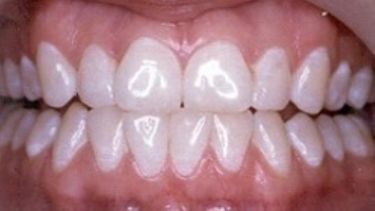 Example of a healthy mouth