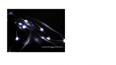Intercalation project image