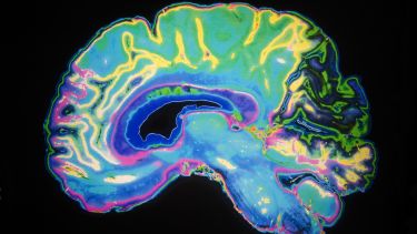 Cross section of brain