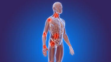 Graphical representation of human body and skeleton