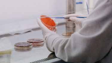Biofilms