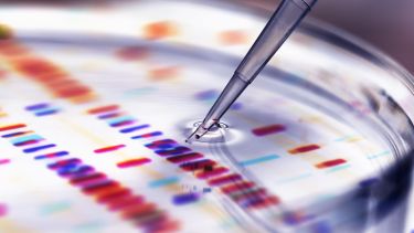 Pipette adding sample to petri dish with DNA profiles in background - stock photo