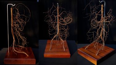 Arteries of the abdomen - anatomy teaching resource