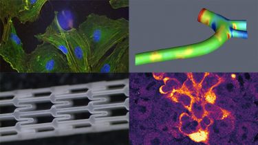 Insigneo Biomaterials, Biomechanics and Cell Engineering research theme collage of images