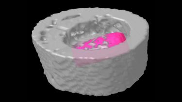 Rat bone with implant