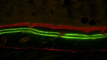Fluorescent quadruple labelling of mouse bone