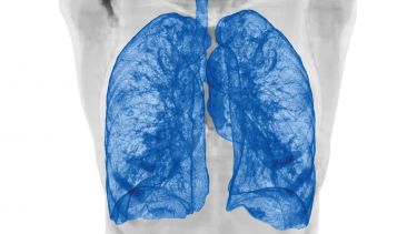 MRI imaging scan of lungs