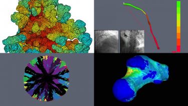 Insigneo computational modelling research theme image collage