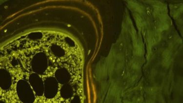Fluorescent quadruple labelling of Human bone biopsy