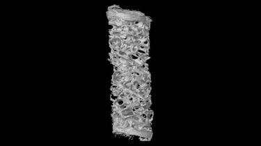 Human biopsy