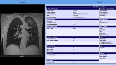 Screenshot of Sheffield-GE Lung Protocol