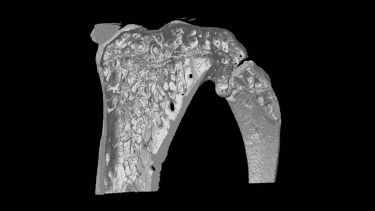 Longitudinal section of Mouse Proximal Tibia