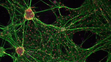 Image showing Stem Cell-derived Enteric Neurons