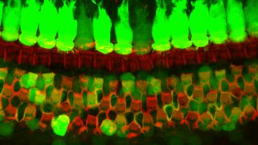 GFP