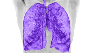 lungs scan