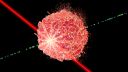 An illustration of laser treatment of a tumour. A red laser beam pierces a tumour. 