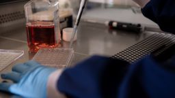 A researcher pipetting liquid