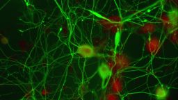 Dentistry research, cultured neurones